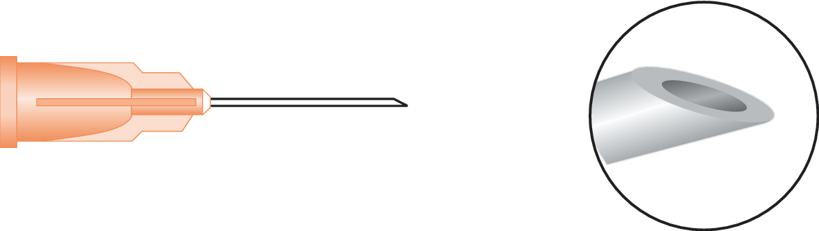 Peribulbar (Atkinson)
